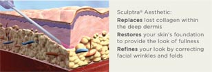 sculptra treatment