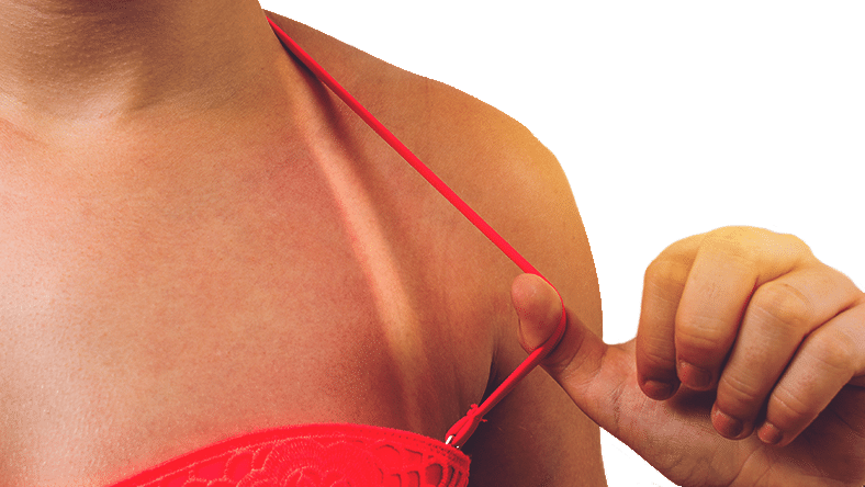diwan-sun-damage-image