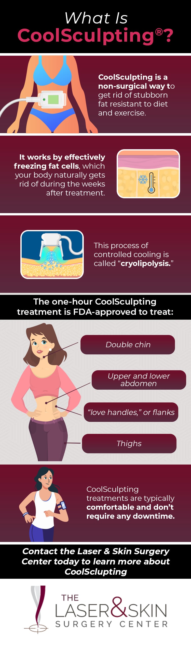 What is CoolSculpting infographic