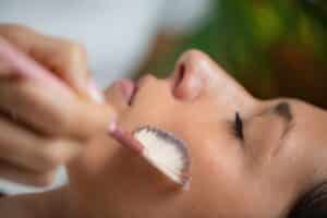 Relaxed woman receives a chemical peel treatment to address multiple skin concerns.