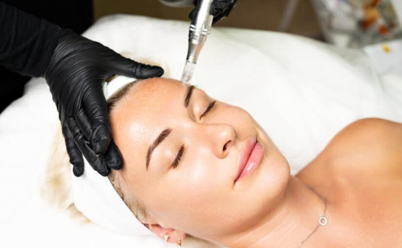 When Is Microneedling a Better Choice Than Laser Resurfacing?